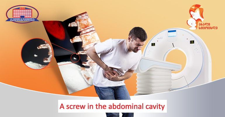 How is the health condition of a patient who had a screw in an abdominal cavity?
